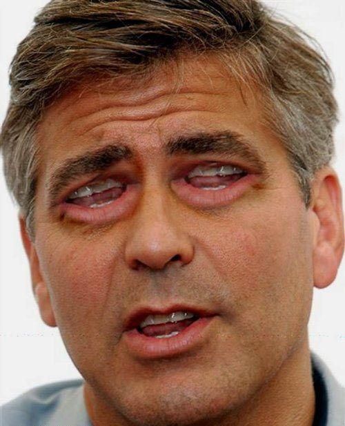 Mouth as Eyes? Amazing Photos of Celebrities!