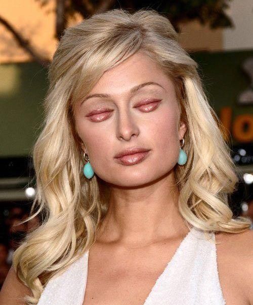 Mouth as Eyes? Amazing Photos of Celebrities!