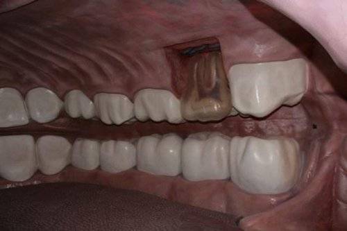 Worlds First Corpus Museum