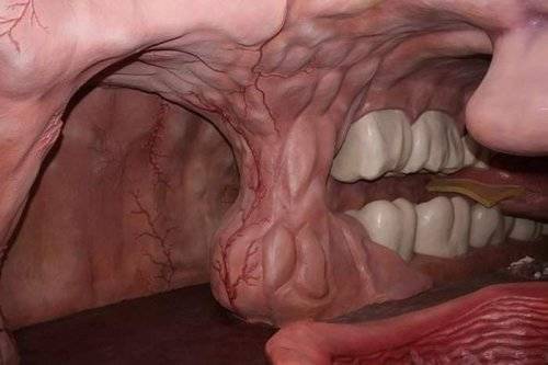 Worlds First Corpus Museum