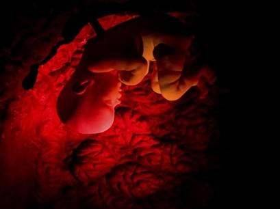 Worlds First Corpus Museum