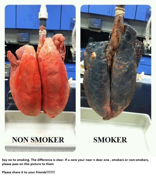 Vital Health Information In Pictures