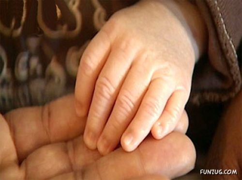 Born With 12 Developed Fingers n Toes