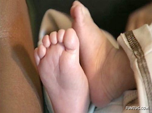 Born With 12 Developed Fingers n Toes