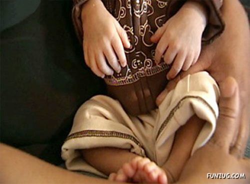 Born With 12 Developed Fingers n Toes