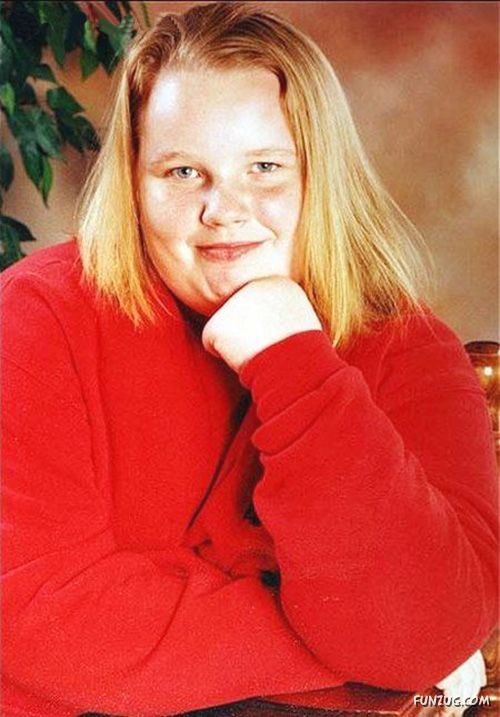 World's Fattest 15-Year-Old Teenager