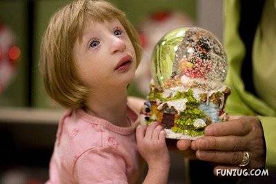 Amazing Smallest Girl in the World