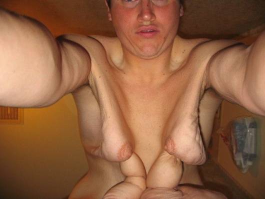 The Chanceless Biggest Loser