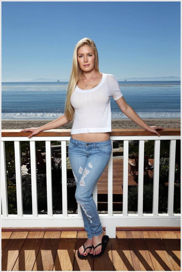 Heidi Montag After And Before Surgery